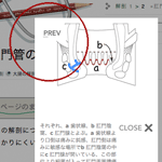 クローン病と経腸栄養