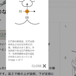 肛門診断マップ