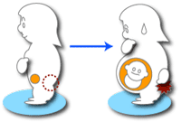 妊娠と肛門病