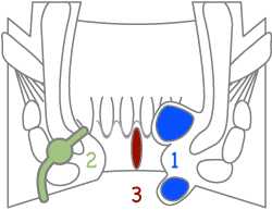 肛門３大疾患