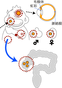 腸管ベーチェット病　単純性潰瘍